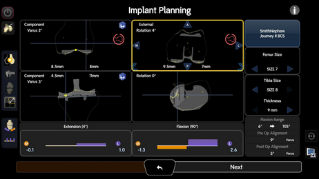 Abb.1 : Intraoperatives Bedienfeld zur präzisen Implantatausrichtung. Die Knieprothese kann in Millimeterschritten 360° im Raum positioniert werden. Gleichzeitig wird das postoperative Ergebnis hinsichtlich der Beinachse und dem wichtigen Gelenkspiel si