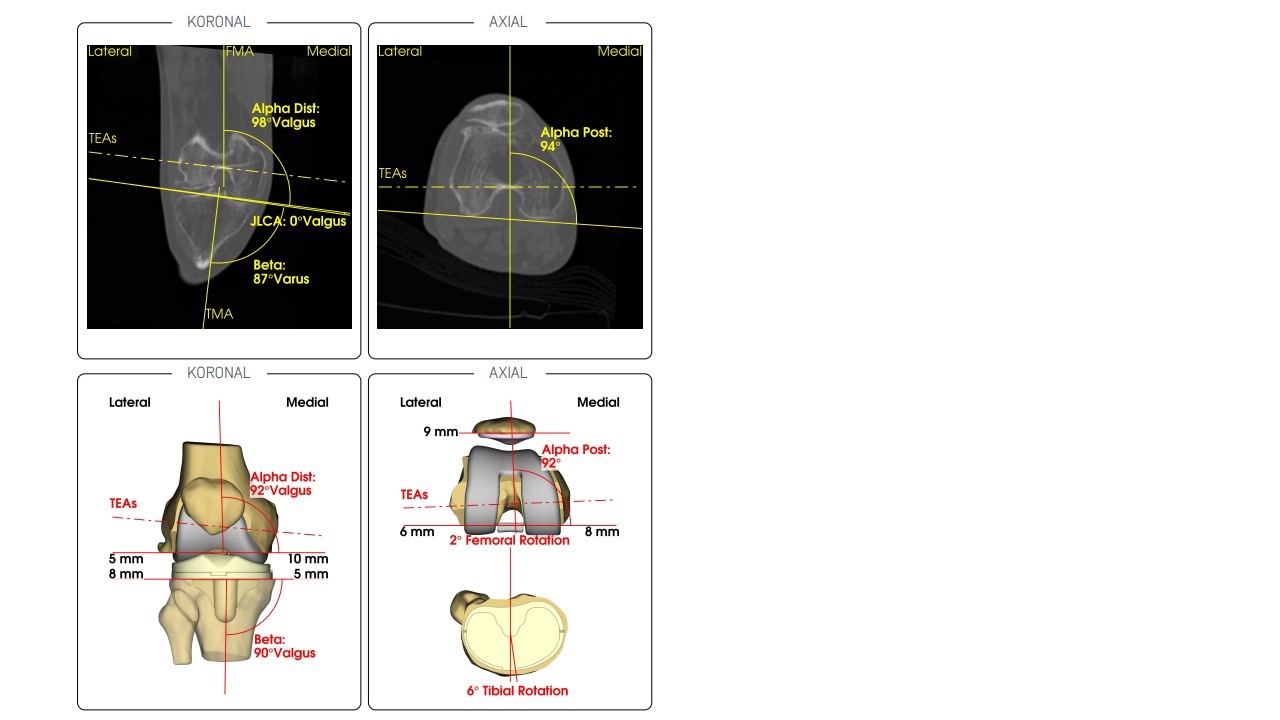 Individuelle Implantate 