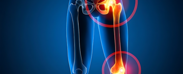 Teilnehmende für Befragung zu Hüft- und Knieschmerzen gesucht